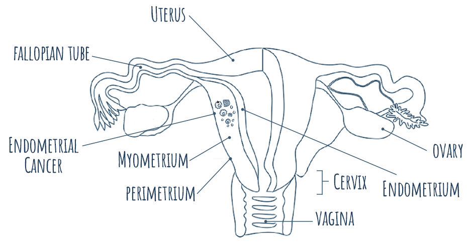 Diagram depicting a uterus